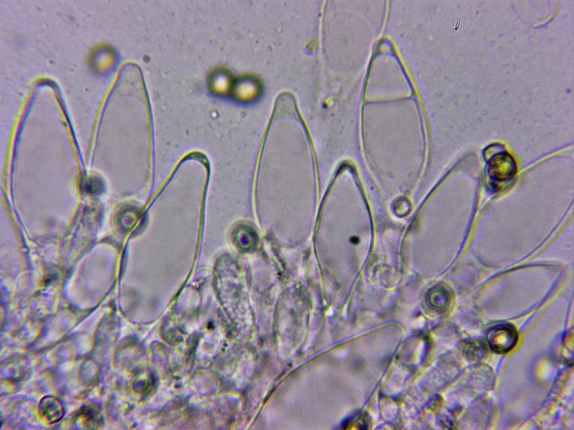 Microscopía de Pluteus chrysophaeus - 10 - Queilocistidios 2